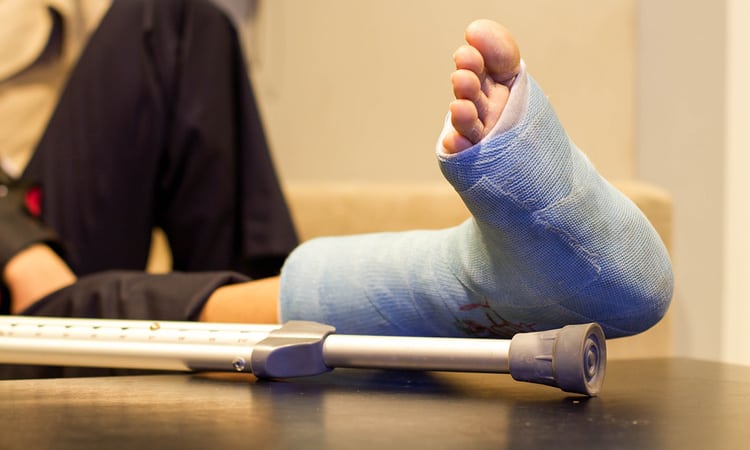 A person resting broken foot on a table.