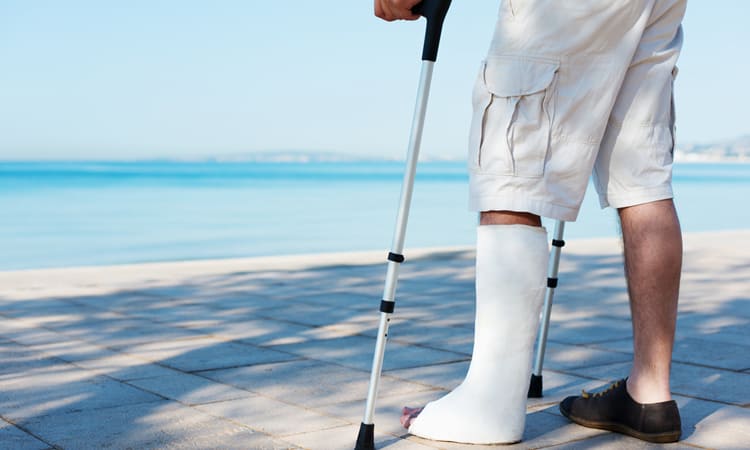 A person with a leg in a cast standing on a beach with crutches.